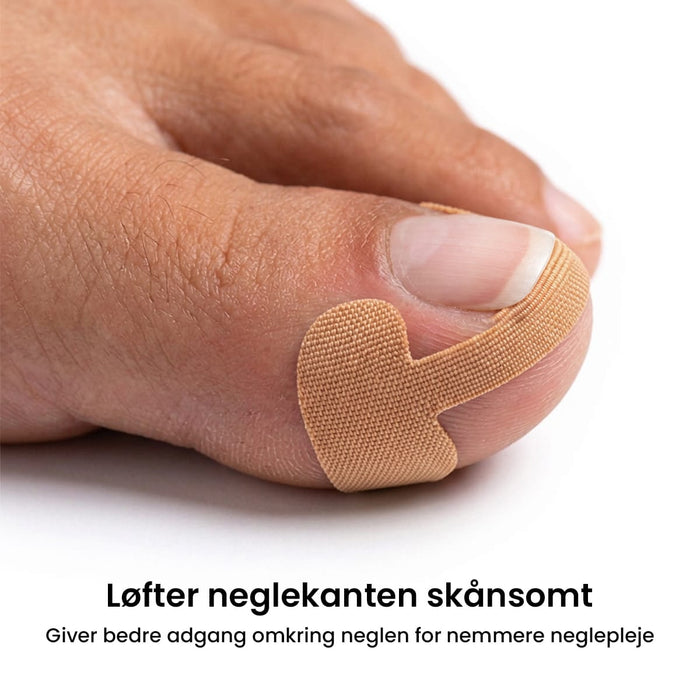 Plaster mod nedgroede negle (12 stk)