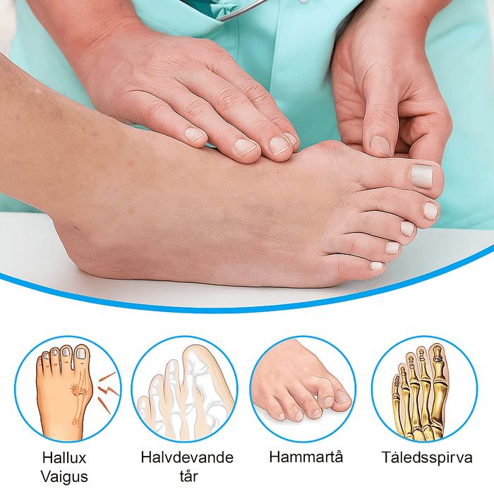 Kroppsbutikken Bunion Bunion lindrende tåafstandshaltere i gel