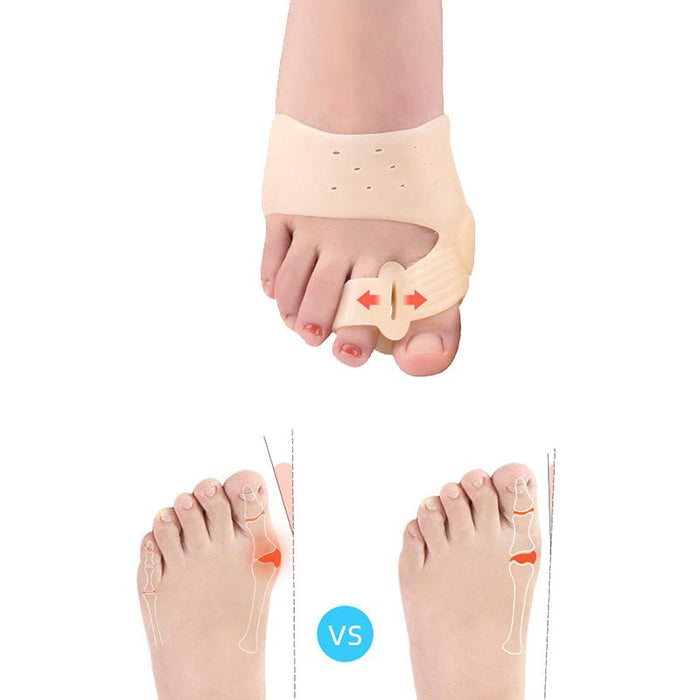 Kroppsbutiken Bunion Bunionkorrektor for naturlig tåposition