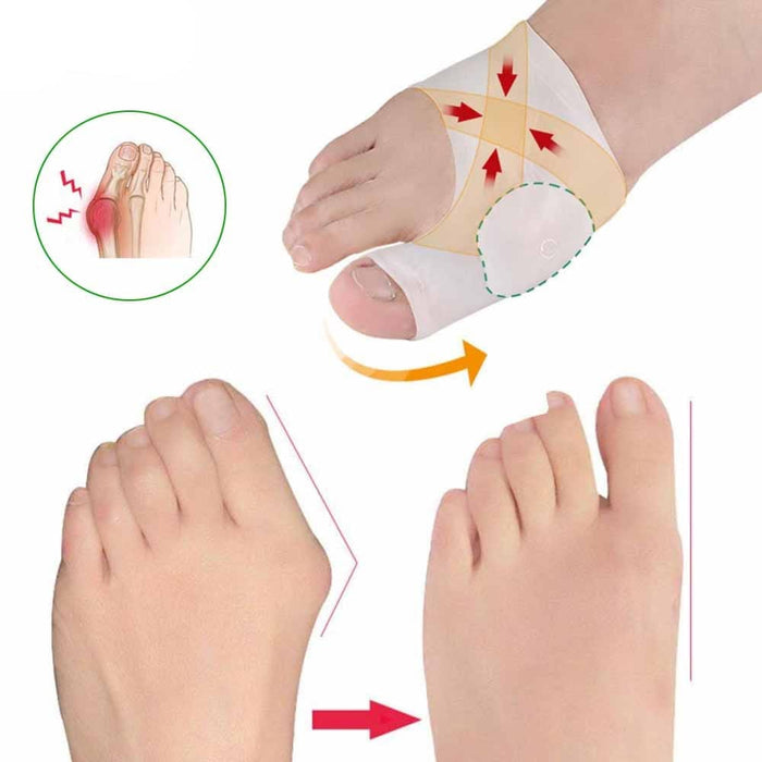 Kroppsbutiken Hallux Valgus Hallux valgus gel sokker