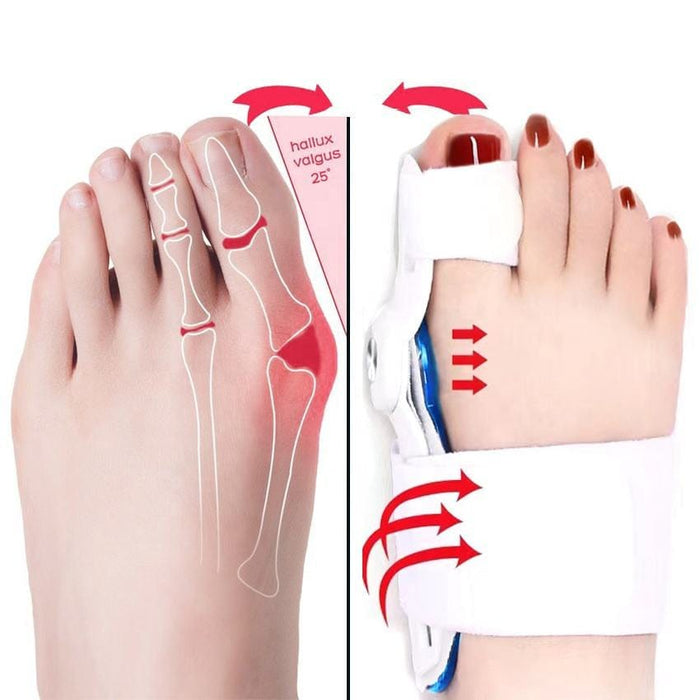 Kroppsbutiken Hallux valgus Hallux valgus nattskinn (korrektor)