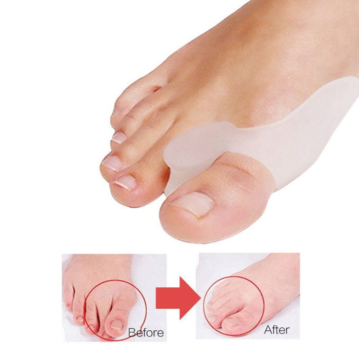Kroppsbutikken Hallux Valgus Hallux valgus støtte 2 stk