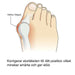 Kroppsbutiken Hallux Valgus Standardtitel Hallux valgus silikonskydd