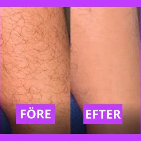 Kroppsbutiken Hårfjerning Standardtitel Silk Ease hårfjerning