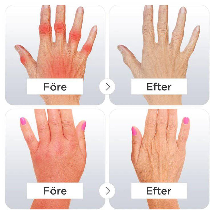 Kroppsbutiken Kompressionshandsker Kompressionshandsker til artrose