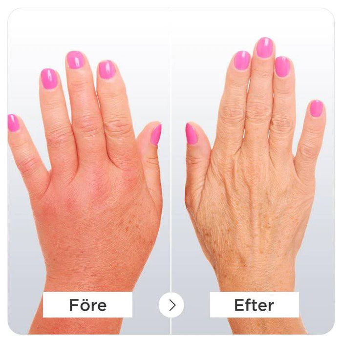 Kroppsbutiken Kompressionshandsker Kompressionshandsker til artrose