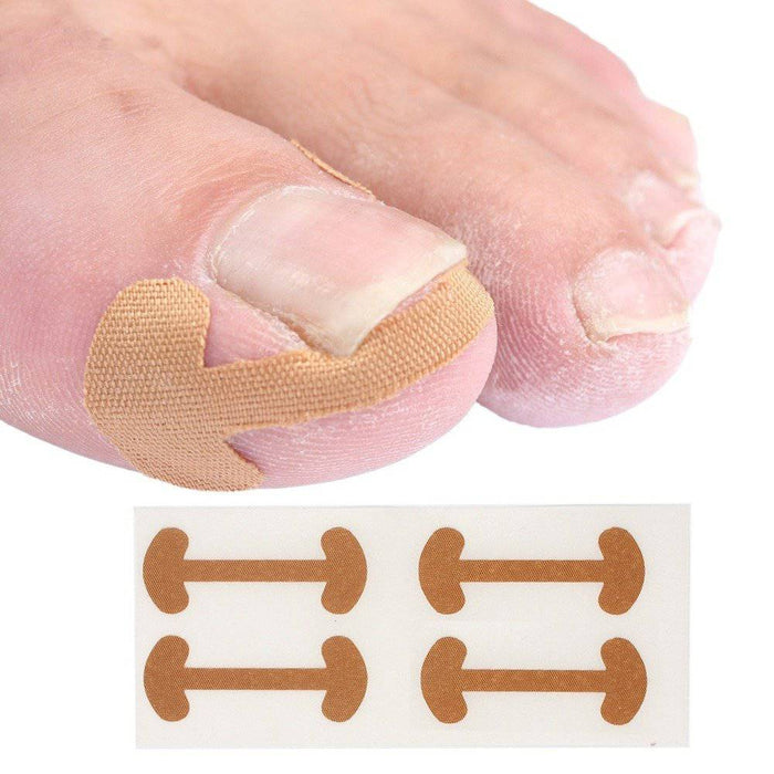 Kropsbutikken Tånailplastre 12stk (one size) Nageltrangsplastre (12stk)