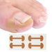 Kropsbutikken Tånailplastre 12stk (one size) Nageltrangsplastre (12stk)