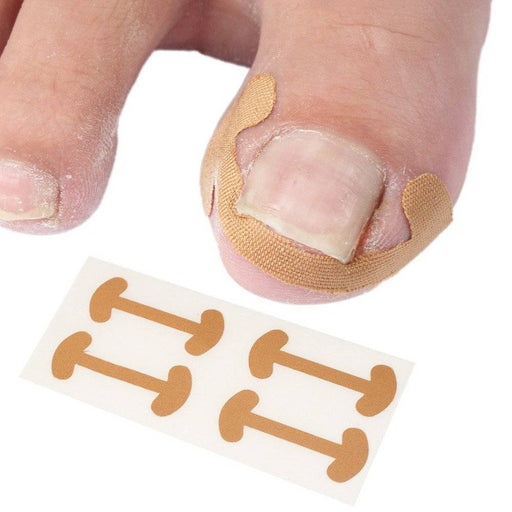 Kropsbutikken Tånailplastre 12stk (one size) Nageltrangsplastre (12stk)