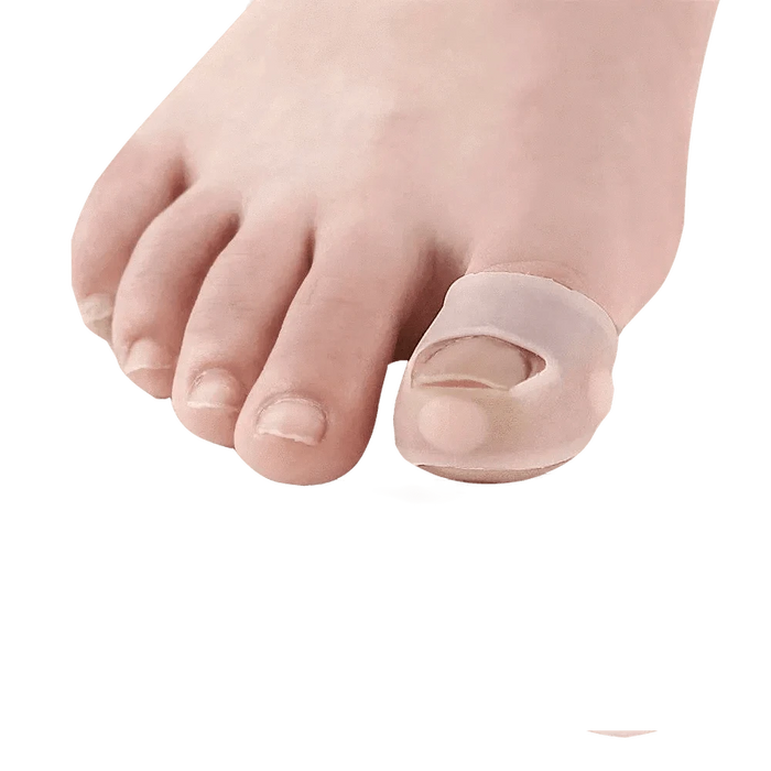 Kroppsbutiken Tånegleregulator Standard titel Tånegle korrigere (2 stk)